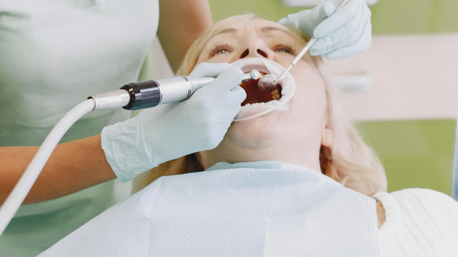 Limpieza dental profesional previa al diseño de sonrisa